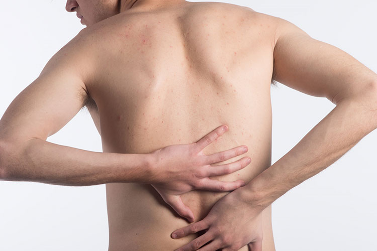 背中の痛みのイメージ画像