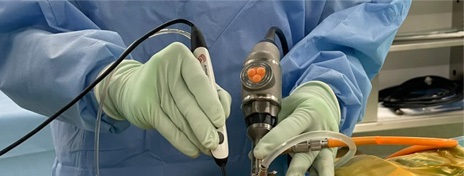 UBE（もしくはBESS）とは